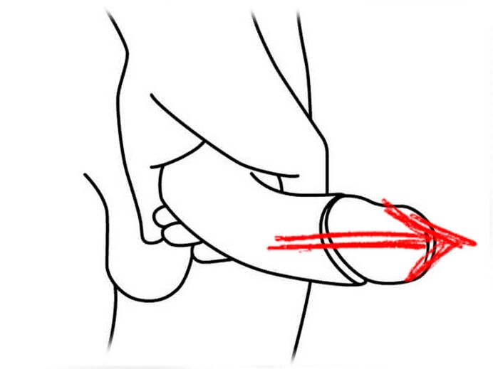 Dehnen Sie den Penis zur Vergrößerung